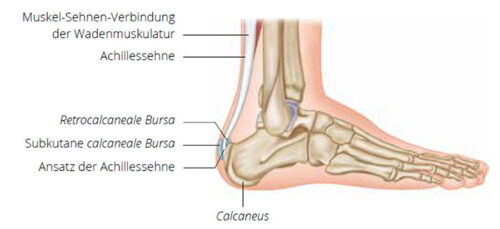 Was kann ich bei einer Entzündung der Achillessehne tun? Ratgeber, Tipps